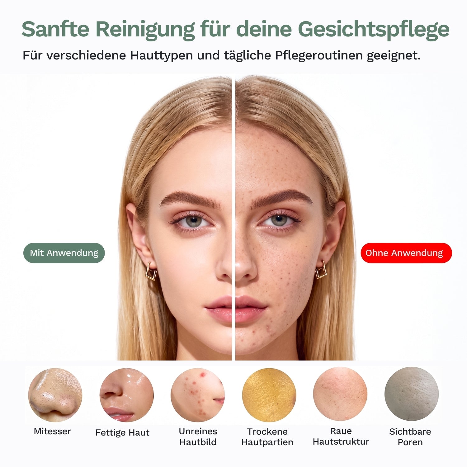 Vorher/Nachher: klarere Haut mit Anwendung der Lazurec Care 083 Gesichtsreinigungsbürste, rechts ohne Anwendung