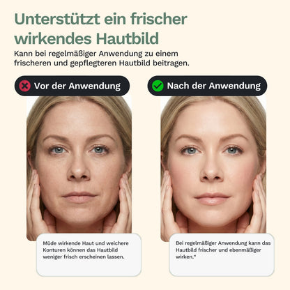 Rolandus G1 - ansigtsmassageapparat